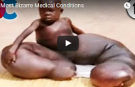 10 Most Bizarre Medical Conditions