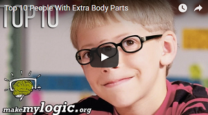 Top 10 People With Extra Body Parts